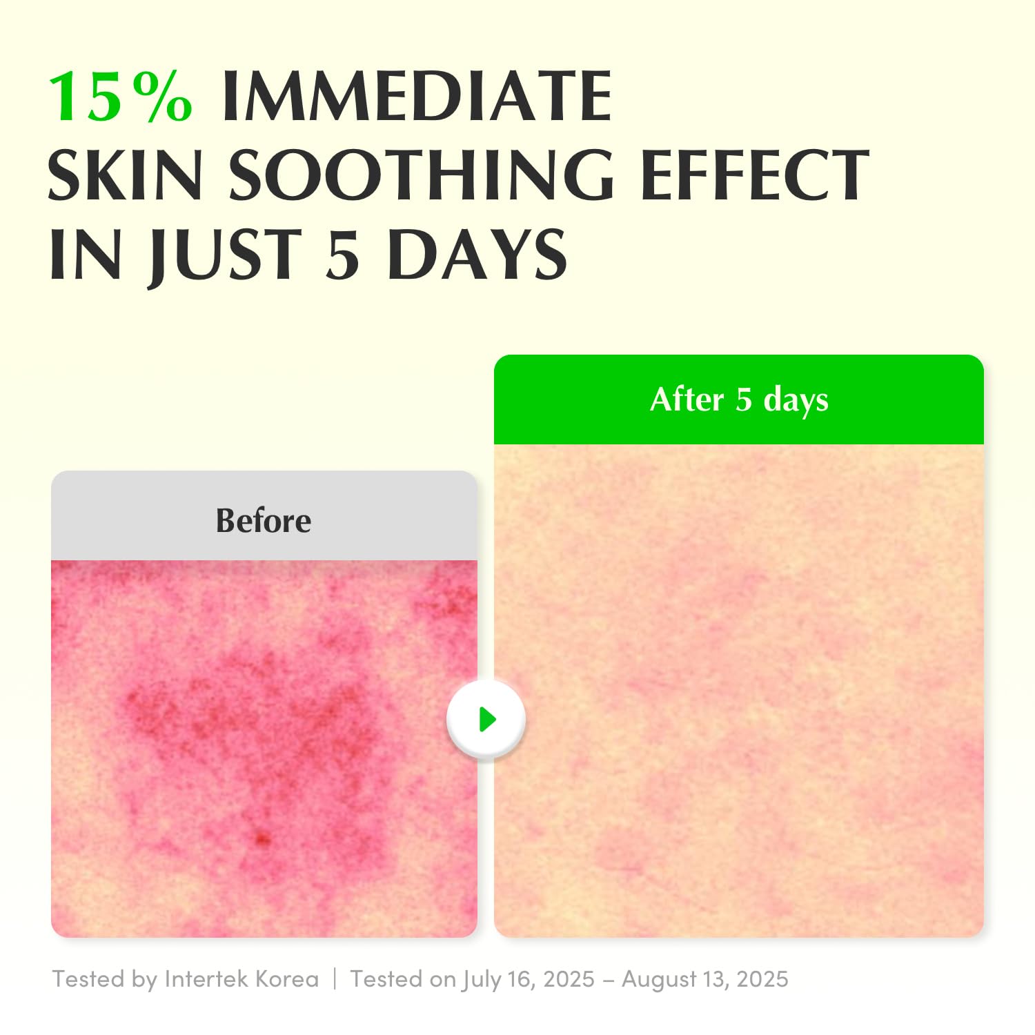 Aloe PDRN Calming Smoothie Serum 30ml – Korean Soothing & Repair Serum